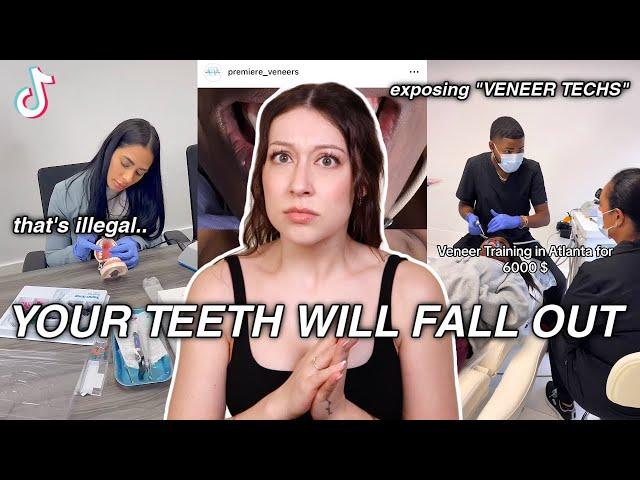 EXPOSING The 'Veneer Techs' of Tiktok! *your teeth will fall out*