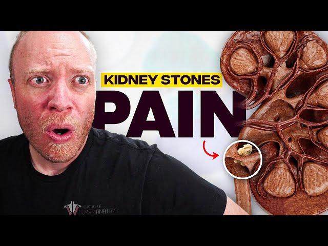 The Most PAINFUL Thing a Human Can Experience?? | Kidney Stones