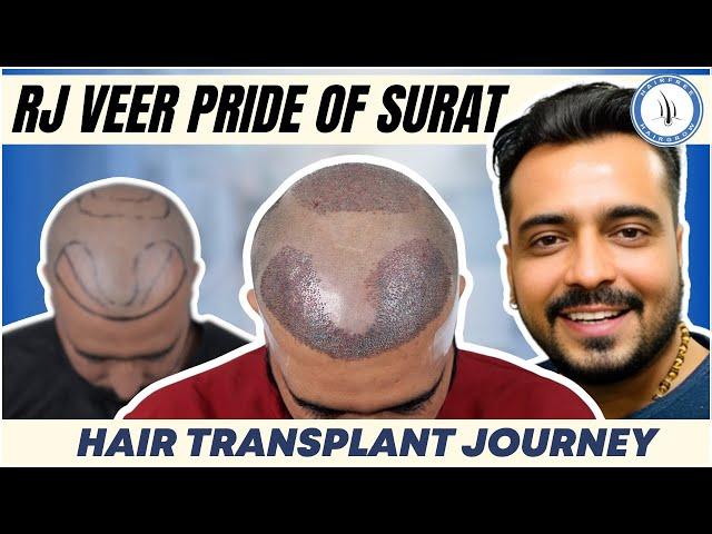 Celebrity Hair Transplant in Surat Gujarat | Hair Transplant Cost in Surat | RJ Veer Radio City