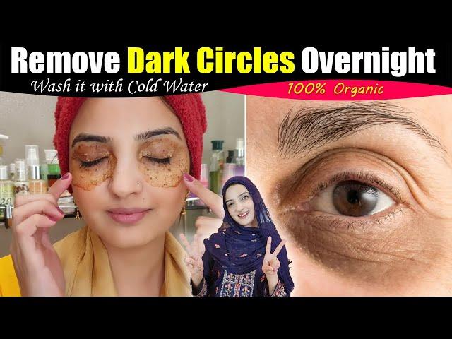 My Friend Told me a Remedy  Remove Dark Circles Fast 100% Permanently at Home