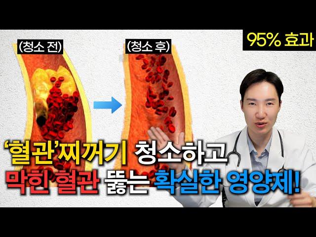 혈관, 제대로 청소해봅시다. 고지혈증까지 해결하는 '이것'