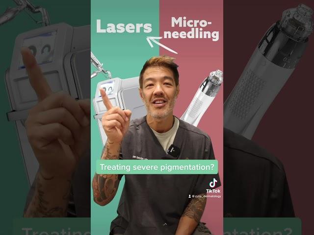 Micro-needling vs Lasers