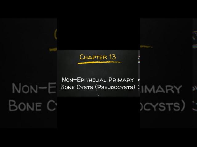 Mnemonic for Solitary Bone Cyst (Scalloping)