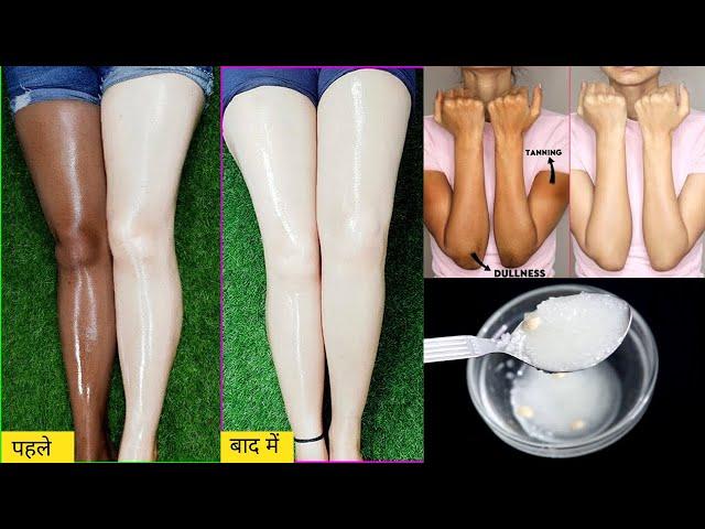 Best Remedy For fairer Body| दूध/नमक से मैं अपने हाथों मे जमी मैल,गंदगी,कालापन मिनटो मे साफ करती हूँ