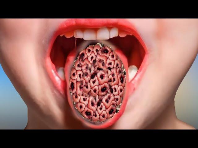 ASMR removal trypophobia Maggots & Worm infected tounge | ASMR Animation Tritment@ViPasmr0.1