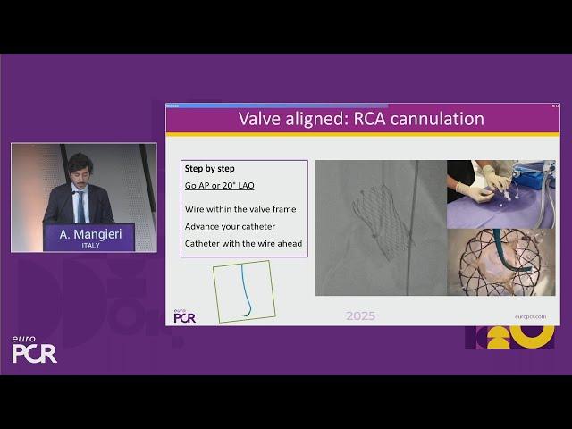 Future-proof your TAVI programme: increased need to enhance pathway efficiencies - EuroPCR 2025
