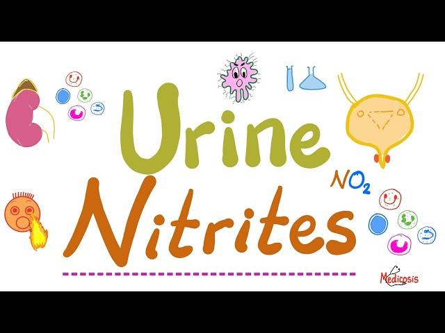 How to diagnose Urinary Tract Infections - UTIs - Urine Nitrites (Urinalysis) - Labs Playlist