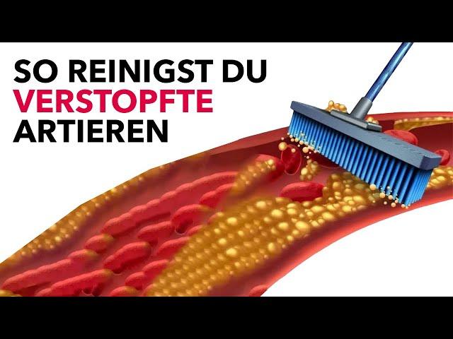 Das sind die 5 besten Mittelchen, um verstopfte Arterien zu reinigen!