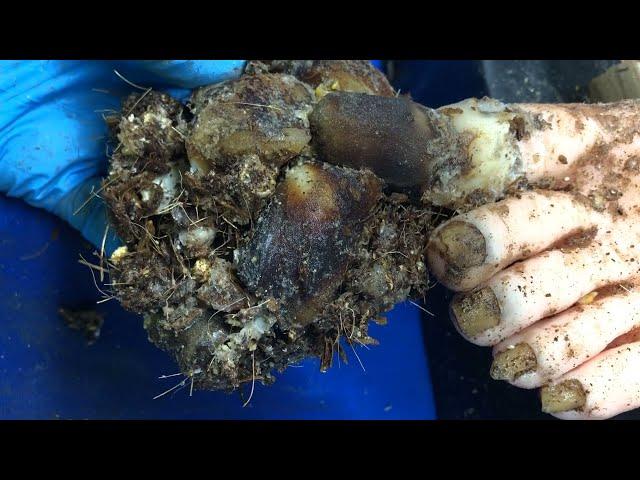 Curly ingrown fungi and bacteria toenails hiding impurities 0993
