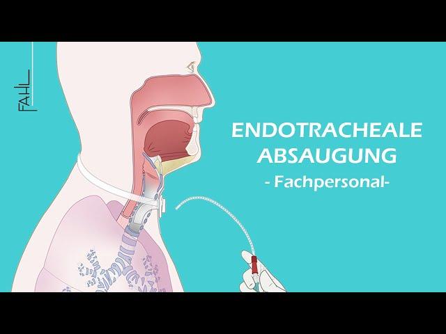 Endotracheale Absaugung für Pflegepersonal | Animation | Fahl Medizintechnik-Vertrieb GmbH