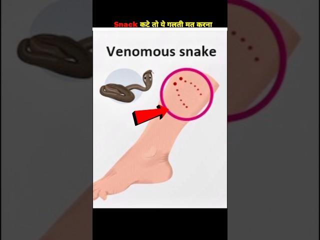 what to do if bitten by a snake || #shorts #fact #sort