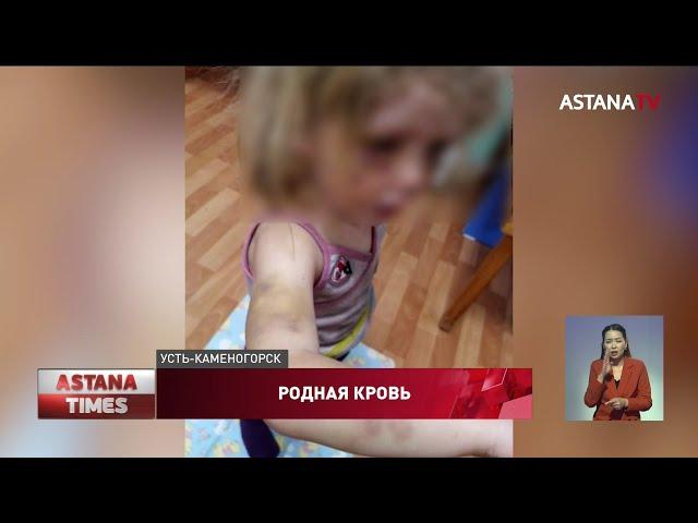 Гнался с ножом: двух маленьких девочек зверски избил родной брат в Усть-Каменогорске