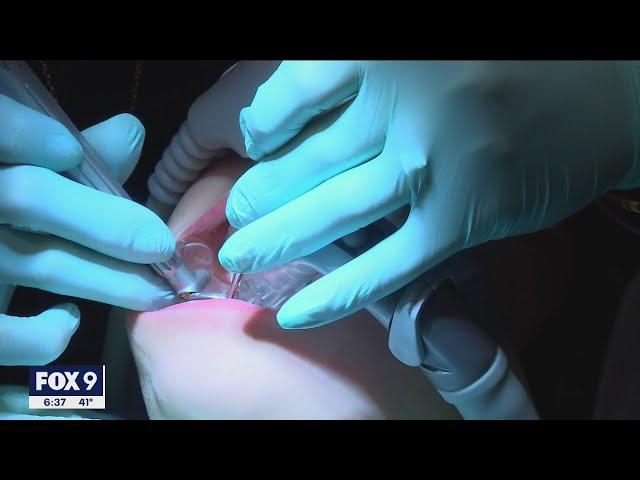 Dentists see increase in stress-related dental issues amid pandemic | FOX 9 KMSP