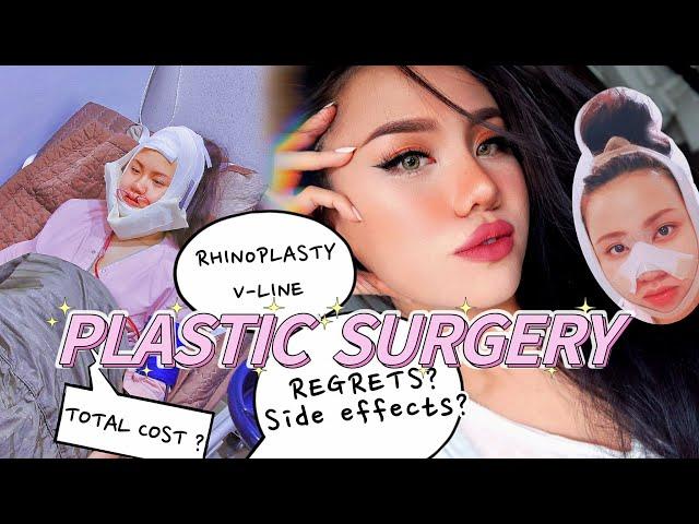 MY PLASTIC SURGERY EXPERIENCE | before & after, cost and regrets with facial contour + rhinoplasty