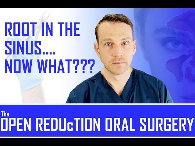 HOW to RETRIEVE a ROOT IN THE MAXILLARY SINUS! DISPLACED ROOT RETRIEVAL TUTORIAL