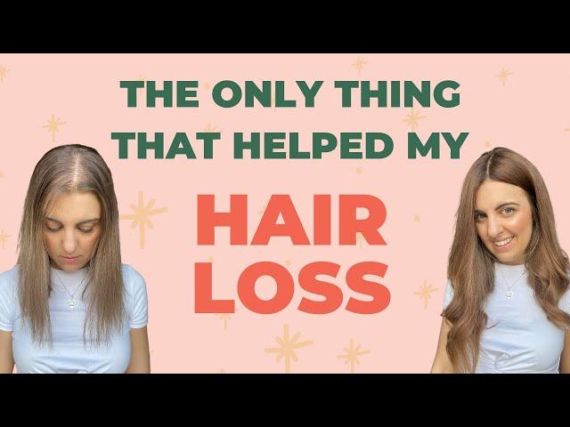 The Only Thing That Helped My Hair Loss!