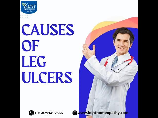 Leg ulcers#legulcers#drkukrejakalani #kenthomeopathyclinic #hiranandanipowai #mumbai#8291492566