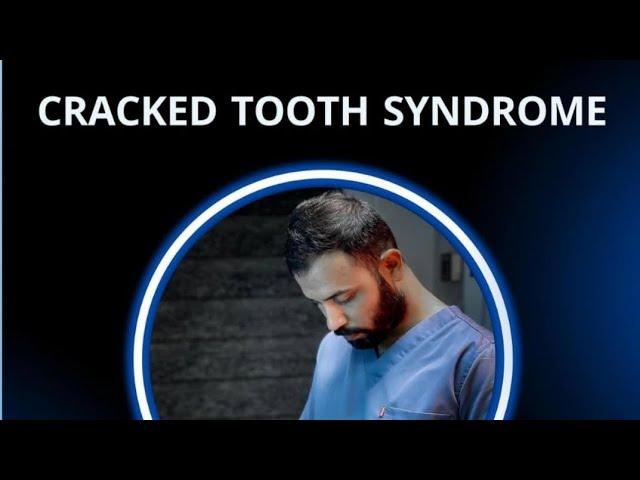 Cracked Tooth Syndrome || Dr-Ahmed Ibrahim (dmp)