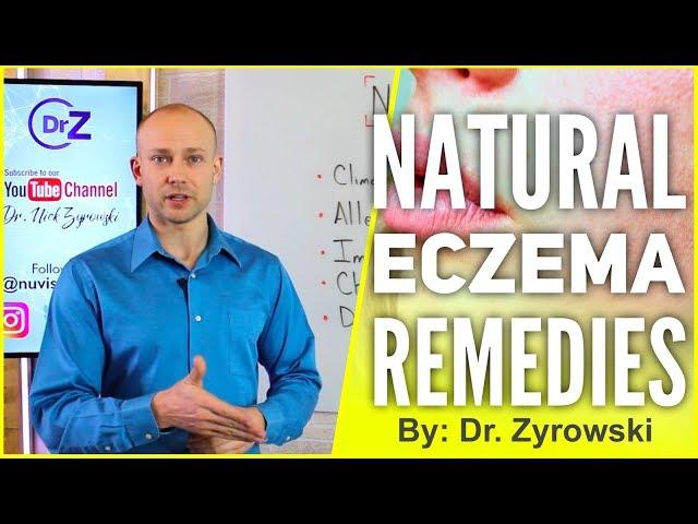 Natural Eczema Remedies | Actually Works!