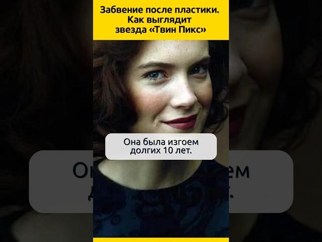 КОНЕЦ КАРЬЕРЫ после пластики. Звезда «Твин Пикс»  #судьба #актриса #кино #жизненныеистории #звезды