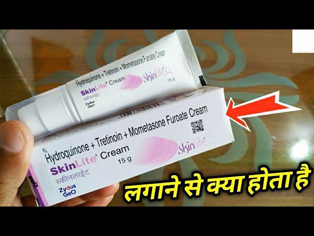 Skinlite Cream Use Karne Ka Tarika| Hydroquinone Tretinoin Mometasone Furoate Cream| स्कीनलाईट क्रीम