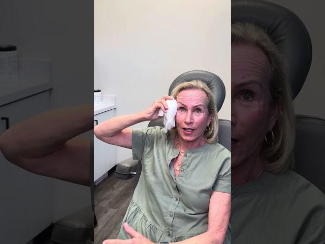 Amazing Facelift Results on 72 Yr Old Patient | L&P Aesthetics