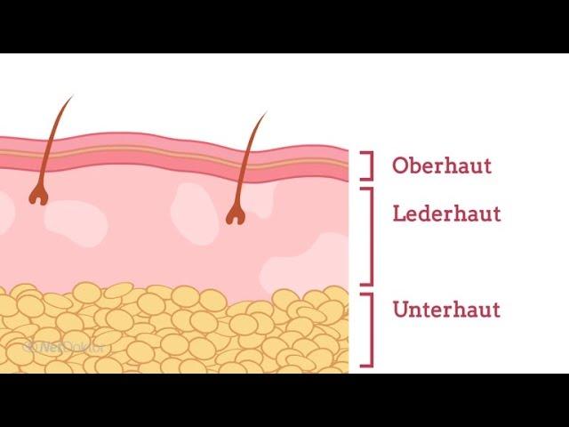 Wie entsteht Neurodermitis? - NetDoktor.de