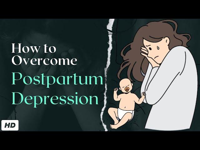 Postpartum Depression