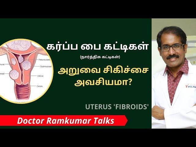 கர்ப்பப்பை பைப்ராய்டு (FIBROIDS) நார்த்திசு கட்டிகள் ஏன்? அறிகுறிகள் என்ன? அறுவை சிகிச்சை தேவையா?