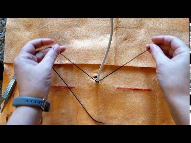 Suture Pattern: Chinese Finger Trap