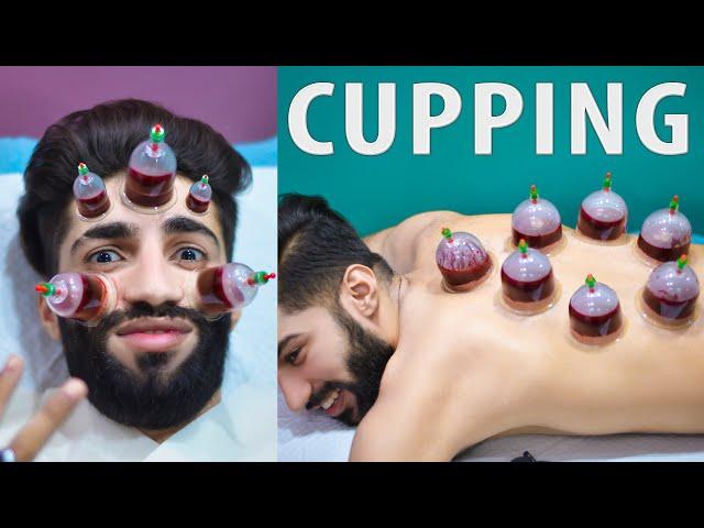 Wet Cupping Therapy \ Hijama for Skin Care | My First Hijama Cupping