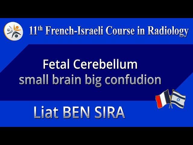 Fetal Cerebellum - small brain big confudion - Liat BEN SIRA