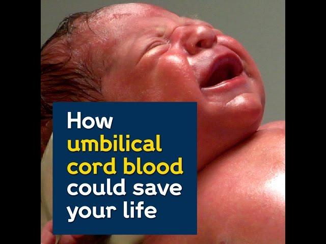 How umbilical cord blood could save your life