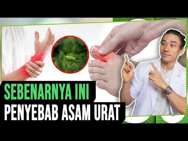 Ini Penyebab Asam Urat yang Sebenarnya