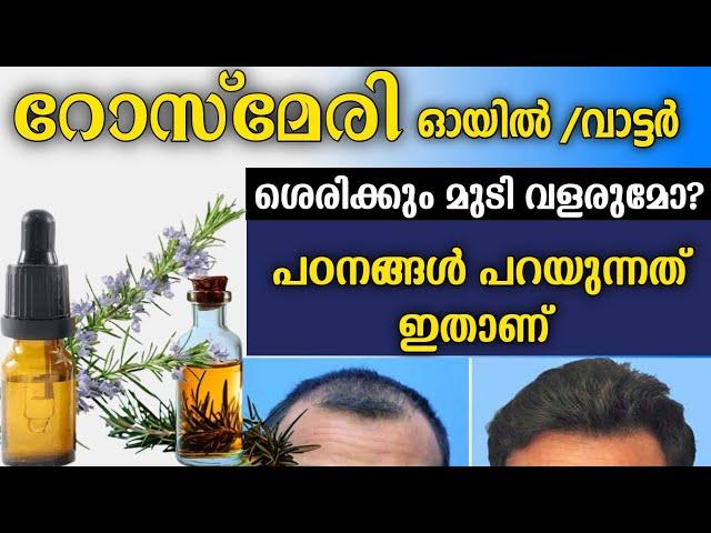 Rosemary oil / water research study | മുടി വളരുമോ? പഠനങ്ങൾ പറയുന്നത് ഇതാണ്