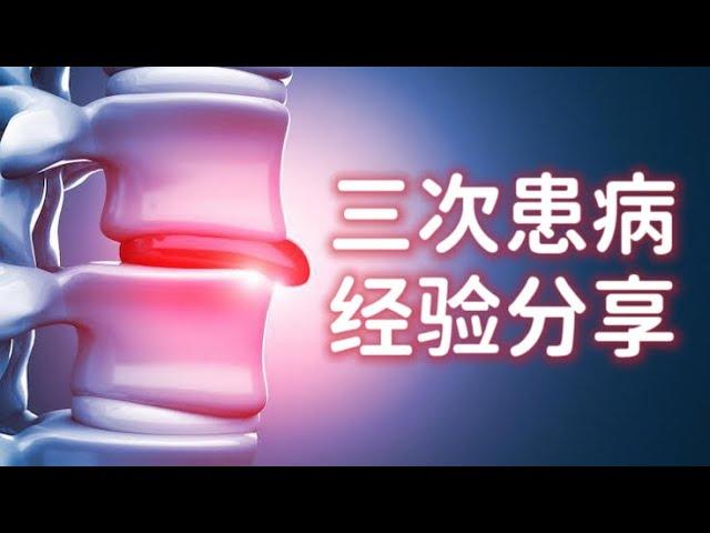 腰椎盘突出的治疗和康复【上】: 腰椎盘突出三次，经历腰椎间盘手术“椎板切除术”，分享患病过程和康复经验