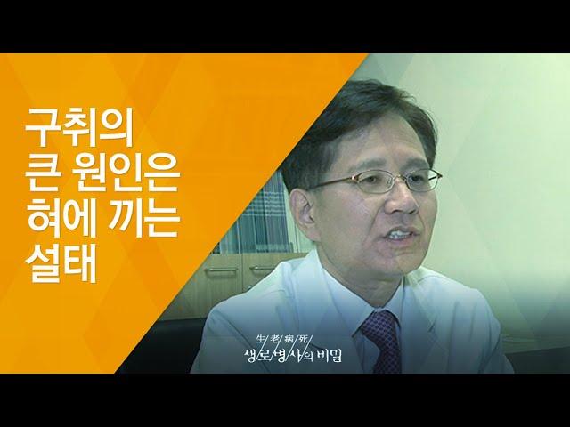 구취의 큰 원인은 혀에 끼는 설태 - (20131023_479회 방송)_노인 냄새는 정말 불쾌한가요?