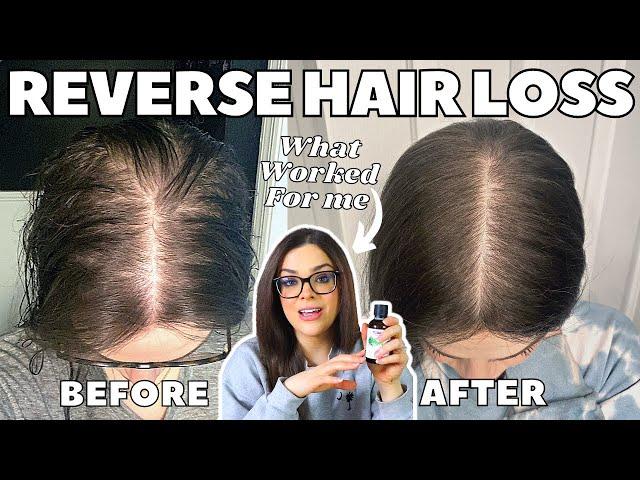 How I STOPPED MY HAIR LOSS! | #1 Thing That Re-Grew My Hair