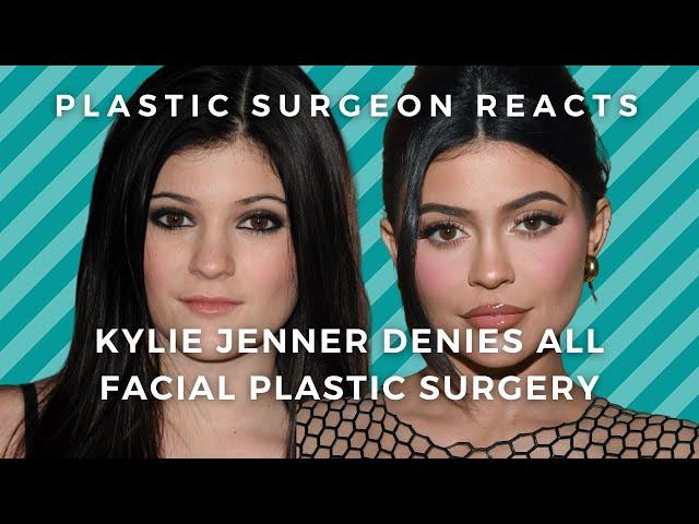 Kylie Jenner denies facial Plastic Surgery: Do we believe her? Plastic surgeon evaluates.