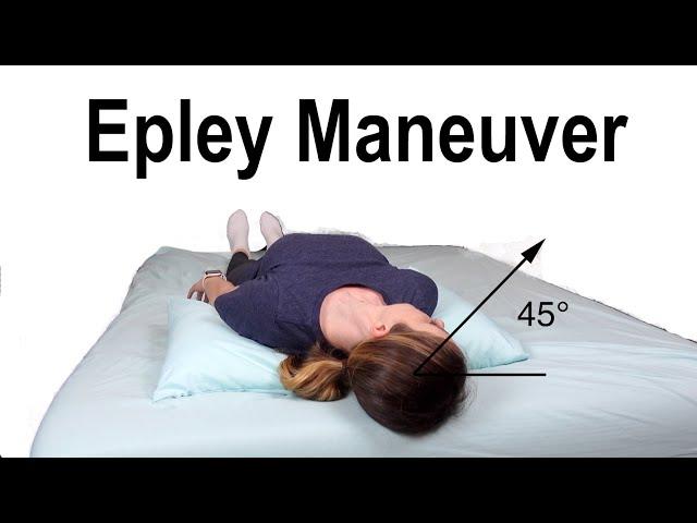 Epley Maneuver to Treat BPPV Dizziness