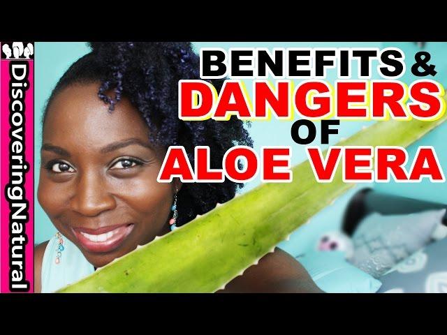 BENEFITS & DANGERS of ALOE VERA | Hair Loss Treatment and Dandruff Treatment | Natural Hair