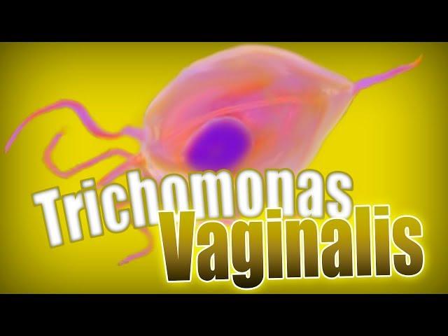 TRICOMONIASIS ️: Trichomonas vaginalis. Clínica y tratamiento: metronidazol | Parasitología clínica