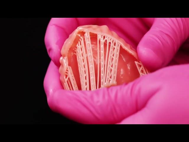 Removing denture 3D print supports!