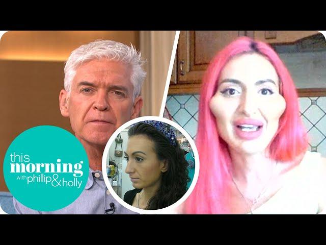 The Woman Addicted To Fillers Who Admits She Has 'No Plans' To Stop | This Morning