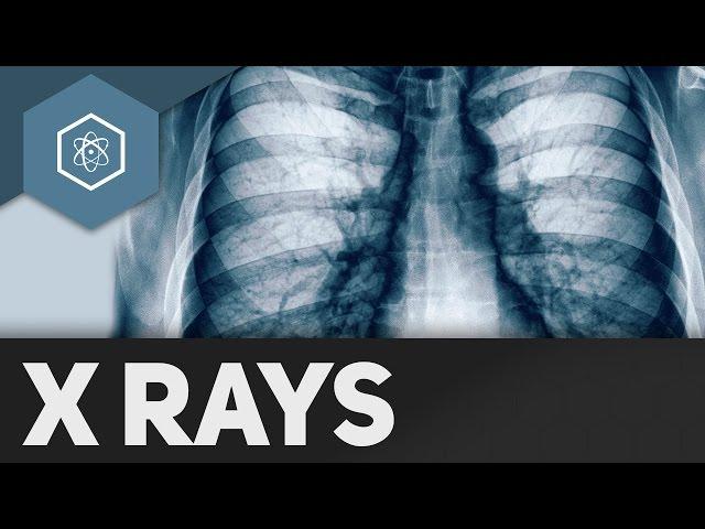 Röntgenstrahlen - Wie funktionieren X-Rays?