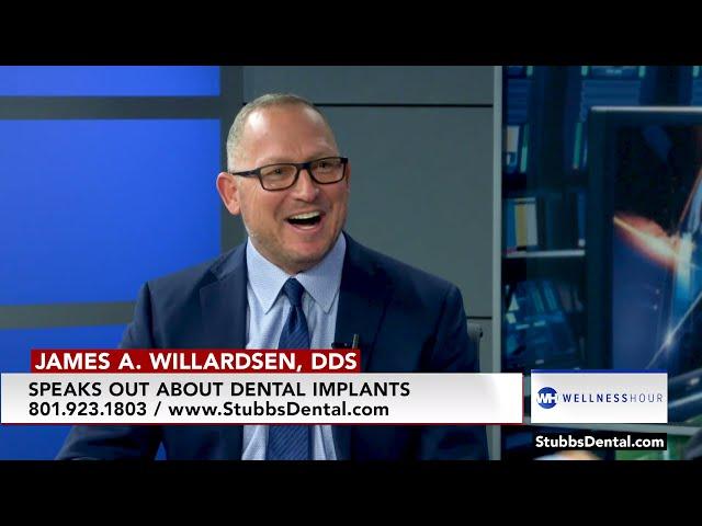 Replacing Missing Teeth with Dental Implants with James Willardsen, DDS | Wellness Hour