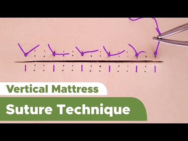 Suture Techniques and Training Series: Interrupted Vertical Mattress Suture Technique