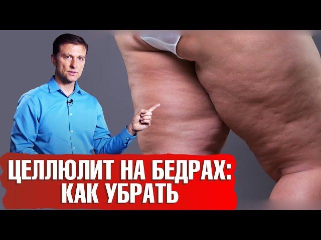 Как избавиться от целлюлита на бедрах? Почему появляется целлюлит? 