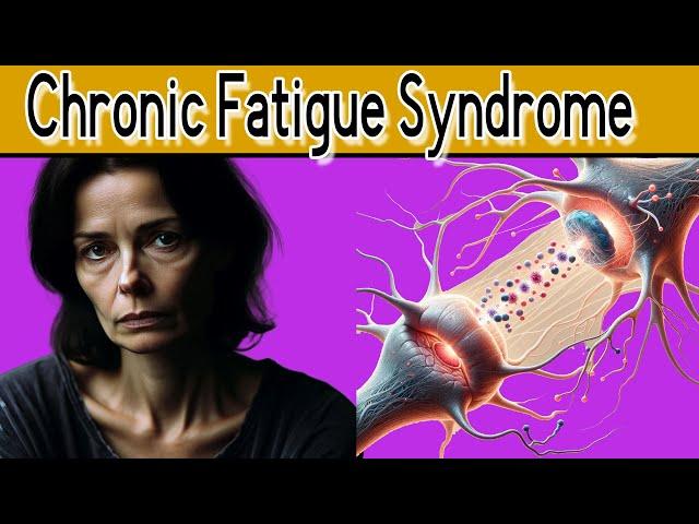 Top 5 Causes of Chronic Fatigue Syndrome: Symptoms, signs and Treatment