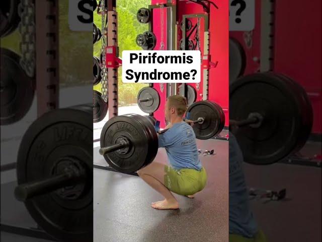 Piriformis Syndrome: HOW TO FIX!